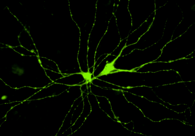 neurona
